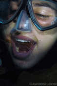 Teeth Cleaning